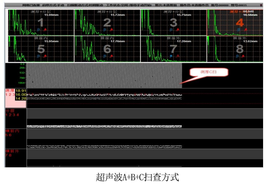 超聲波掃查顯示